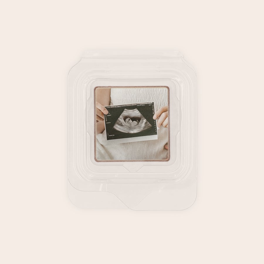 Personalised photo chocolates - Individually wrapped Clear chocolate favour printed with an ultrasound photo for delicious chocolate favours